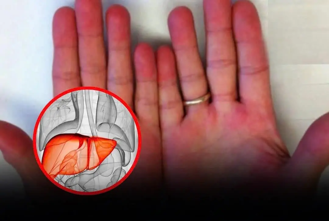 If it’s red, itchy, and smelly twice your body may be in trouble