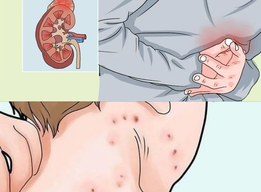 Early Signs of Kidney Disease & How to Protect Your Kidneys