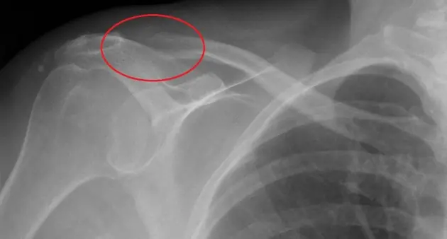 You may be drinking this every day — here’s what it could mean for your bones