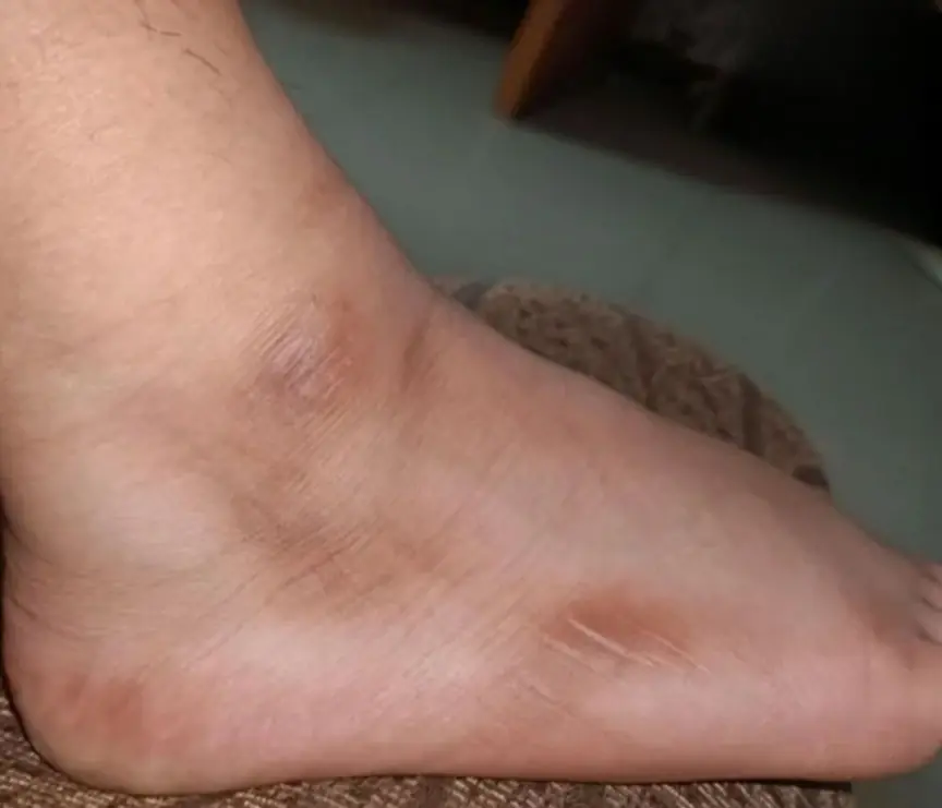 Heavy, cold, or tingling legs? Here’s what it could mean