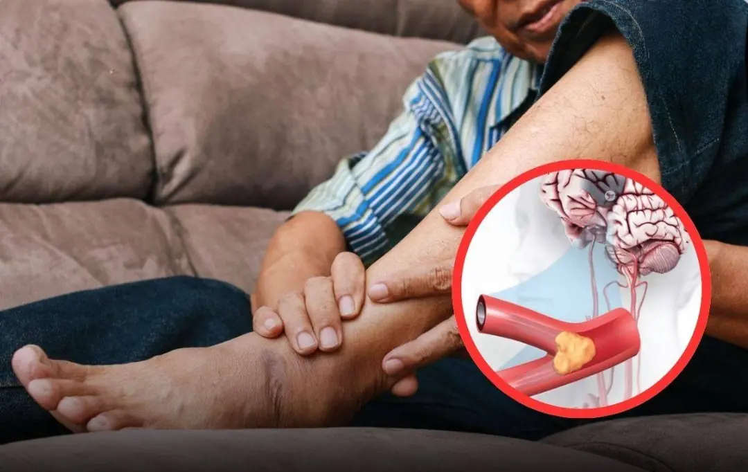 6 Nighttime Signs in Your Arms or Legs You Shouldn’t Ignore (Stroke Risk Explained Clearly)