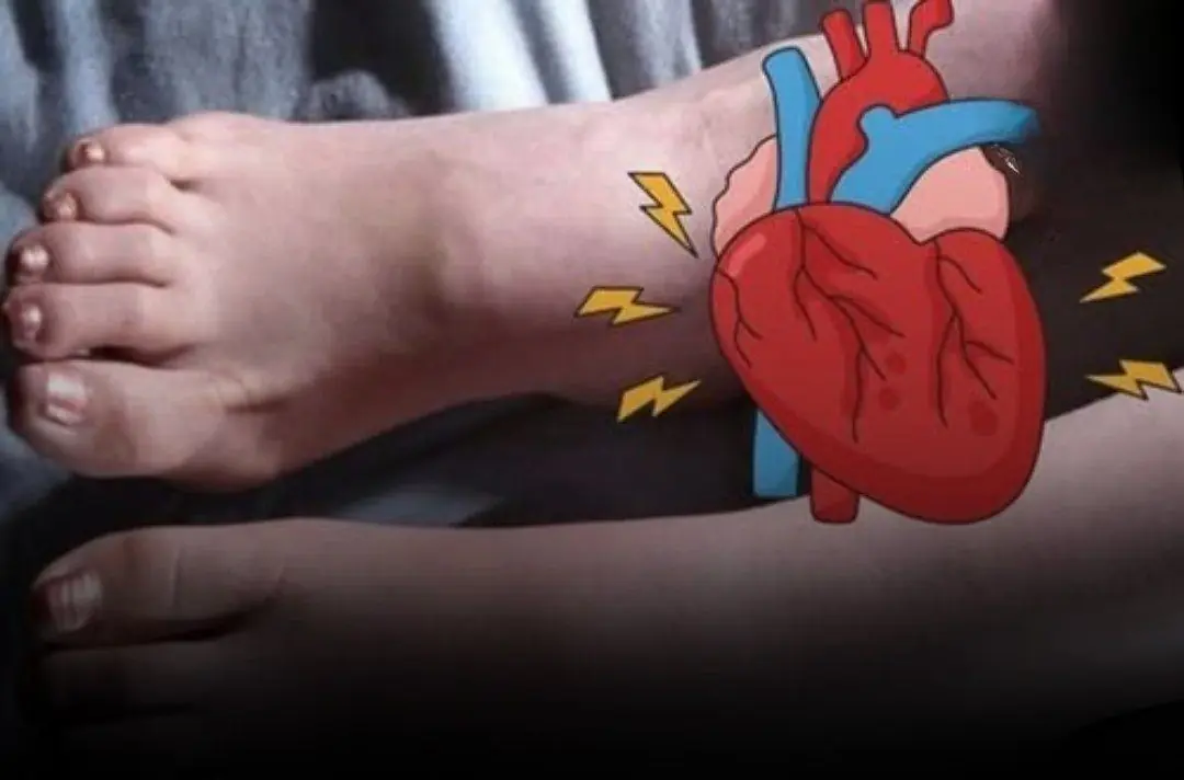 6 foot symptoms that could signal a heart attack weeks before it happens