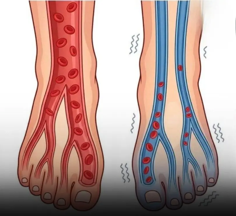 Feel Tired All the Time? It Might Be Your Circulation