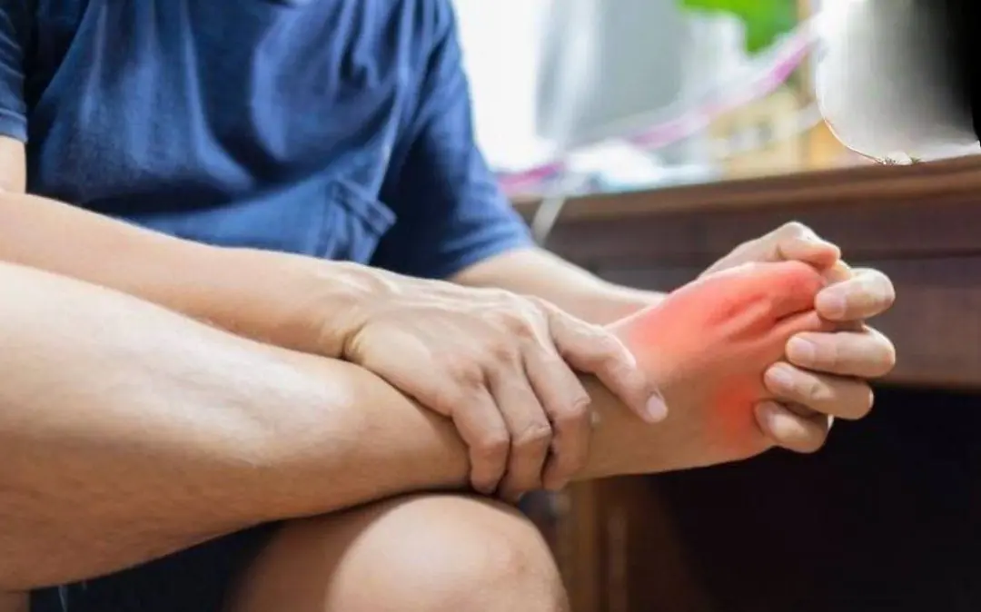 5 Foot Signs That Might Indicate Your Kidneys Need Attention