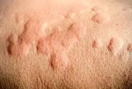 He thought it was nothing more than a simple allergy — until doctors uncovered something far more alarming.