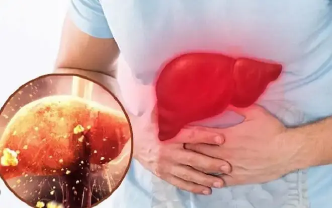 These 5 habits may be damaging your liver right now—are you doing any of them?
