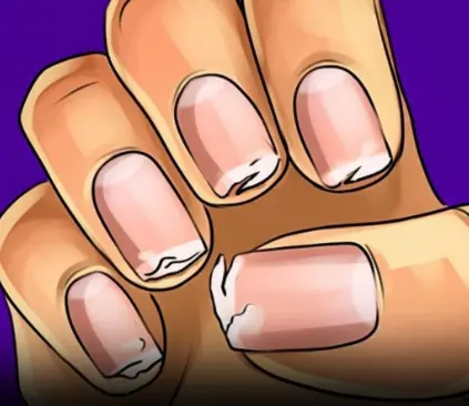 You Should Never Ignore These 9 Things Your Fingernails Reveal About Your Health