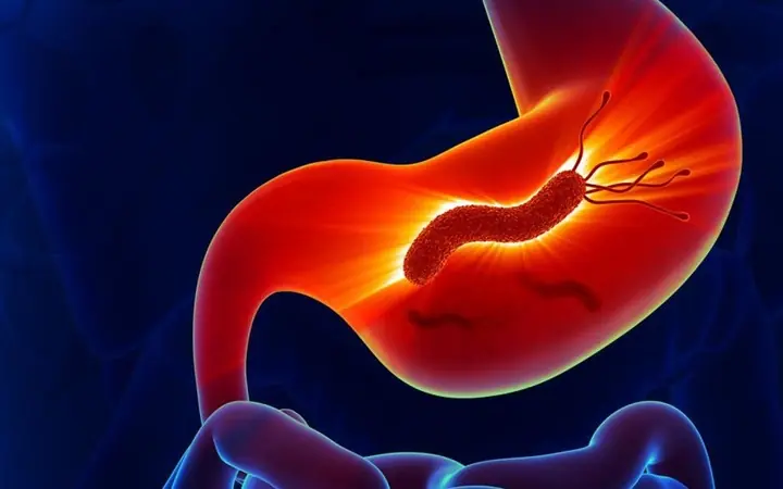 “I Didn’t Know That Could Be a Symptom”: Hidden Signs of Helicobacter pylori You Shouldn’t Ignore