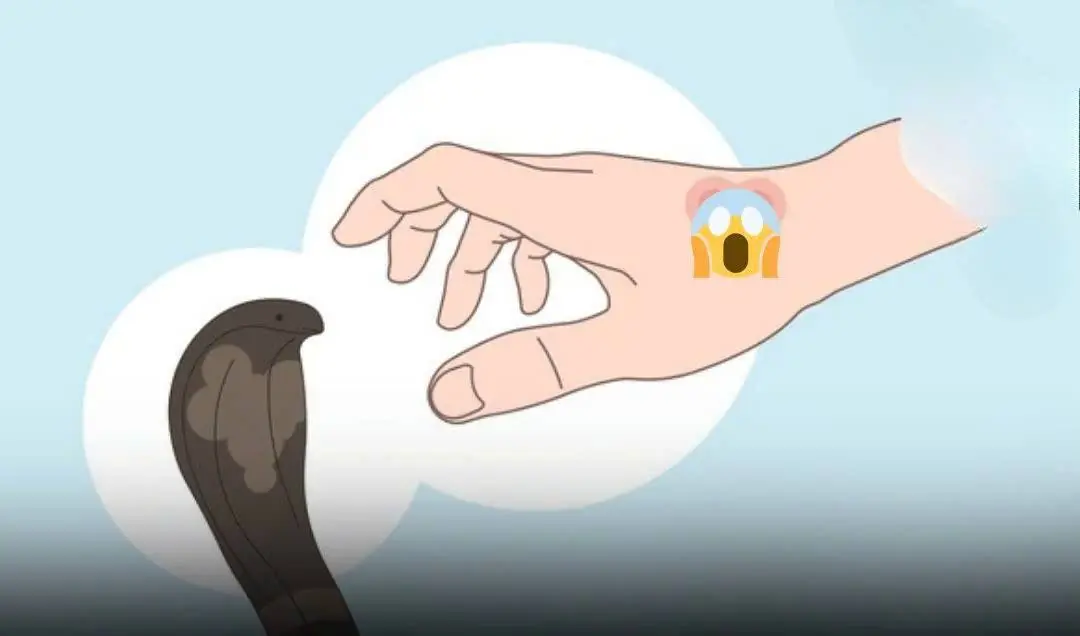 Snake Bite? These Critical First Steps Can Save a Life