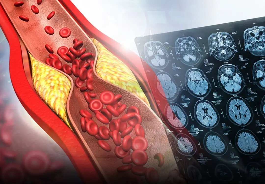 Start Your Day Right: 3 Morning Habits People With High Blo:od Pressure Should Avoid