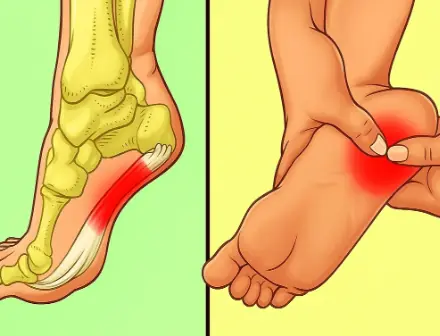 7 Powerful Exercises to Relieve Heel Pain and Treat Plantar Fasciitis Naturally