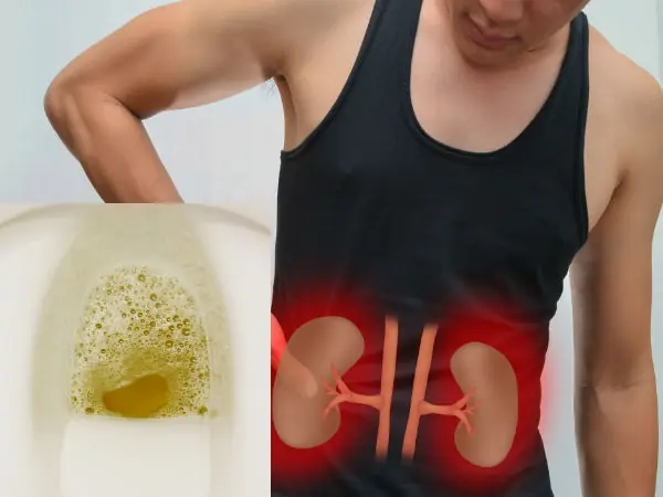 Doctors Warn: Foamy Urine May Signal an Underlying Condition…