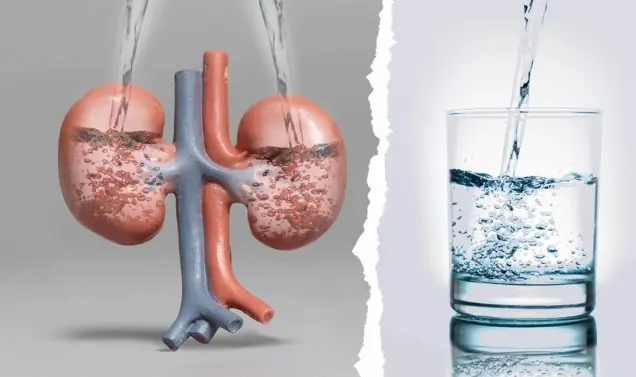 Kidney fai.lure develops quietly - don’t forget to take these preventive steps