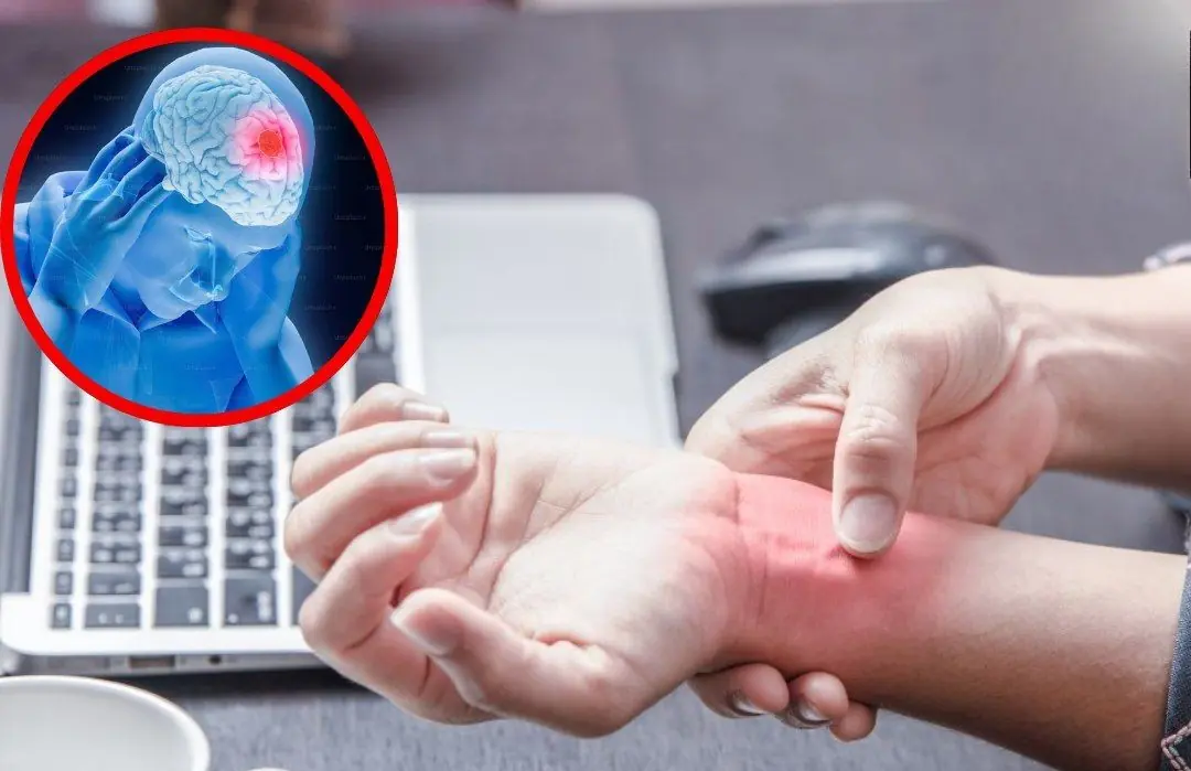 More than just numb hands and feet: 7 key warning signs of a str.oke