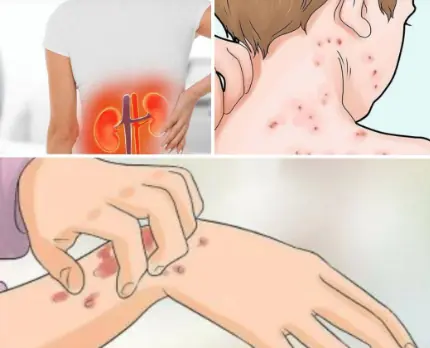 If Your Kidneys Are in Danger, the Body Will Show these 10 Signs