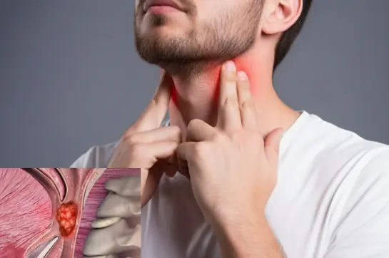 Naso.phary.ngeal can.cer: The quiet dis.ease you shouldn’t ignore - signs, risks and how to protect yourself