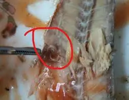 Food Safety Alert: 4 Foods That May Pose a Risk of Parasitic Exposure