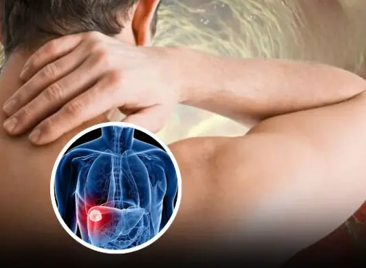Shoulder discomfort may warn of liver can.cer in its early stages