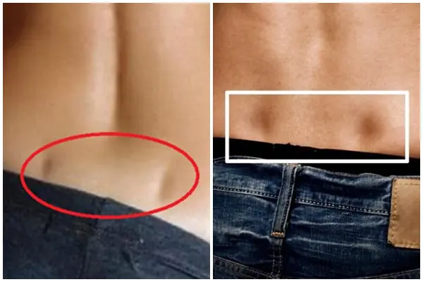 What Do Those Two Dimples on Your Lower Back Actually Mean?