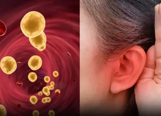 4 Subtle Clues on Your Body That Point to High Blo.o.d Fa.t