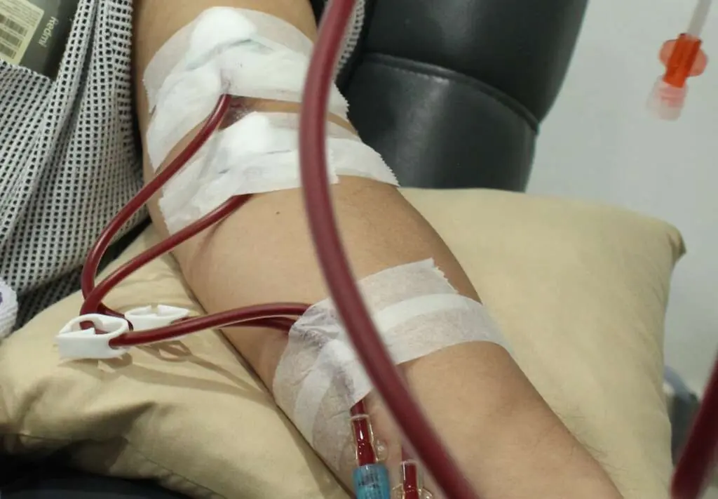 45-Year-Old Driver Suddenly Diagnosed with Kid.ney Failure: Doctors Reveal a Cause Linked to Job Characteristics