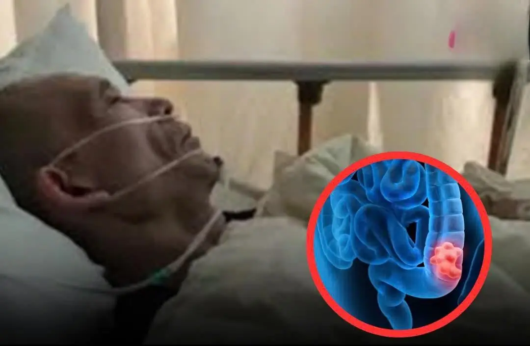 Many people believe that col.on can.cer only comes from eating pickled foods