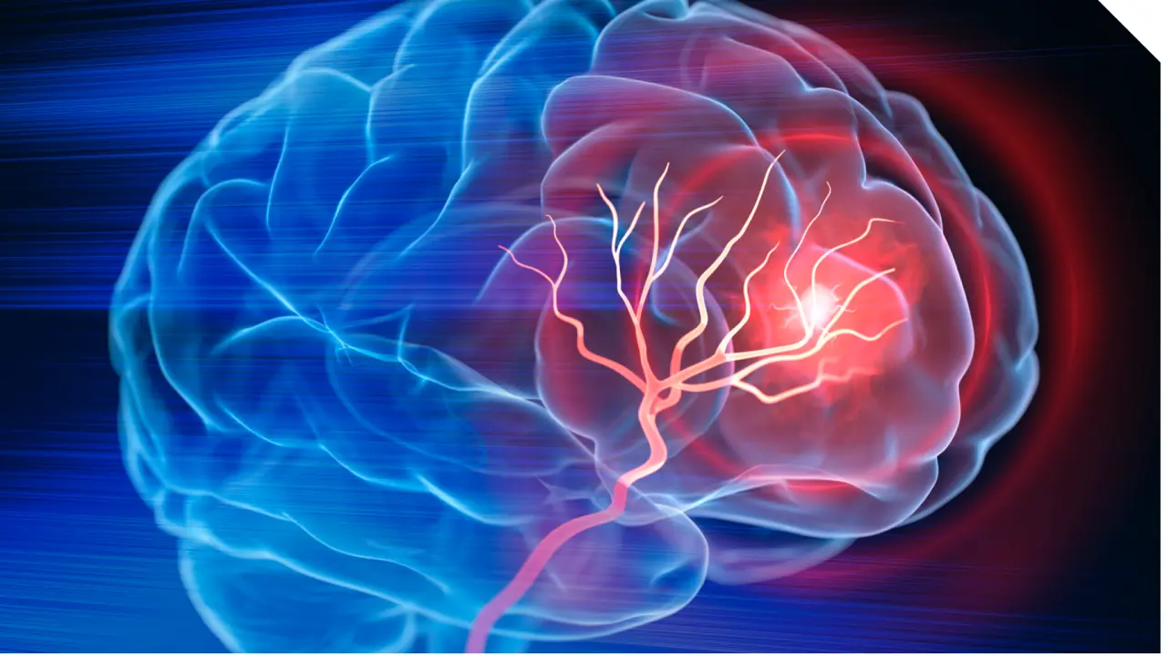 4 Common Morning Habits That Could Quietly Increase Your Risk of Stro.ke