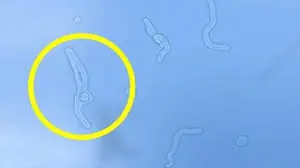 Floaters in your vision? Here’s what an eye doctor says