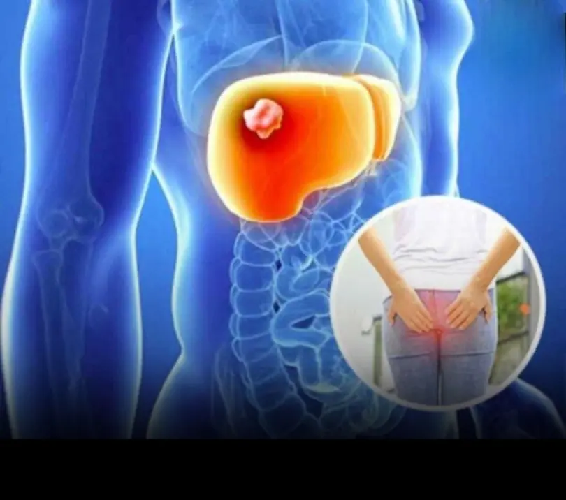 Li.ver Can.cer Doesn’t Start Loud—It Starts Quiet