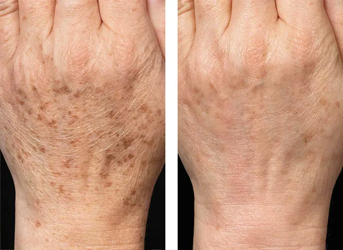 Have you ever heard that marks on your hands might mean you have…