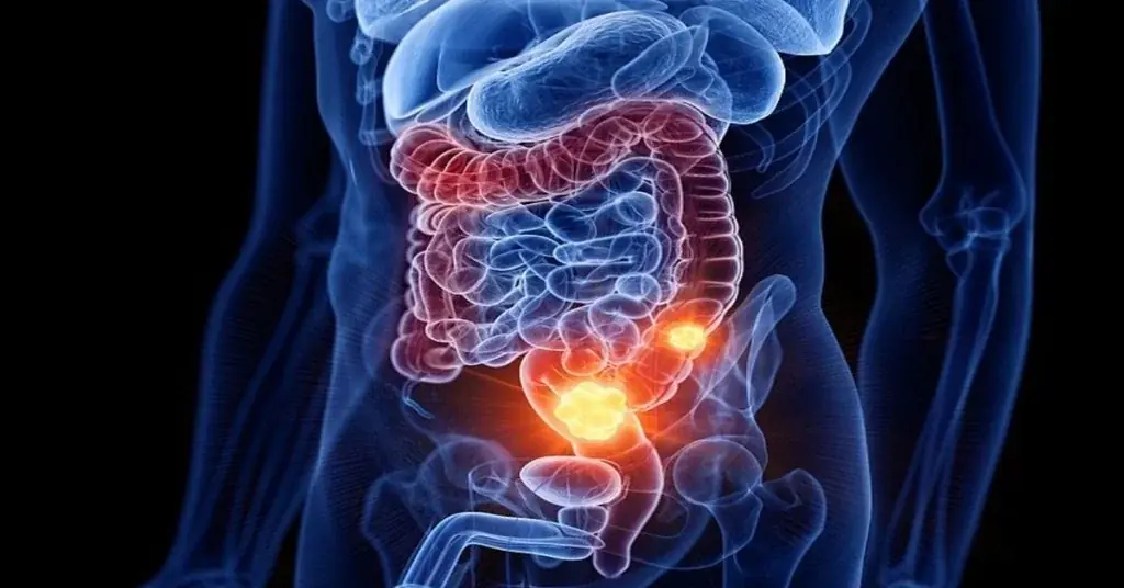 A stage four colon cancer patient speaks out about five symptoms she wishes she hadn’t ignored