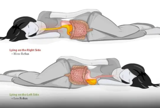 What sleeping on the left side