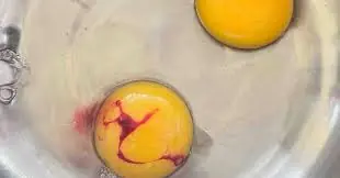 Seeing Blood Spots in Eggs? Experts Explain If They’re Safe
