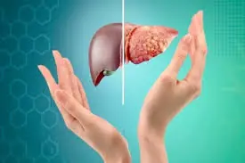 Watch out for these 5 early signs of fatty liver disease