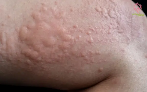 Doctors revealed a more alarming truth after he initially thought it was just an allergy