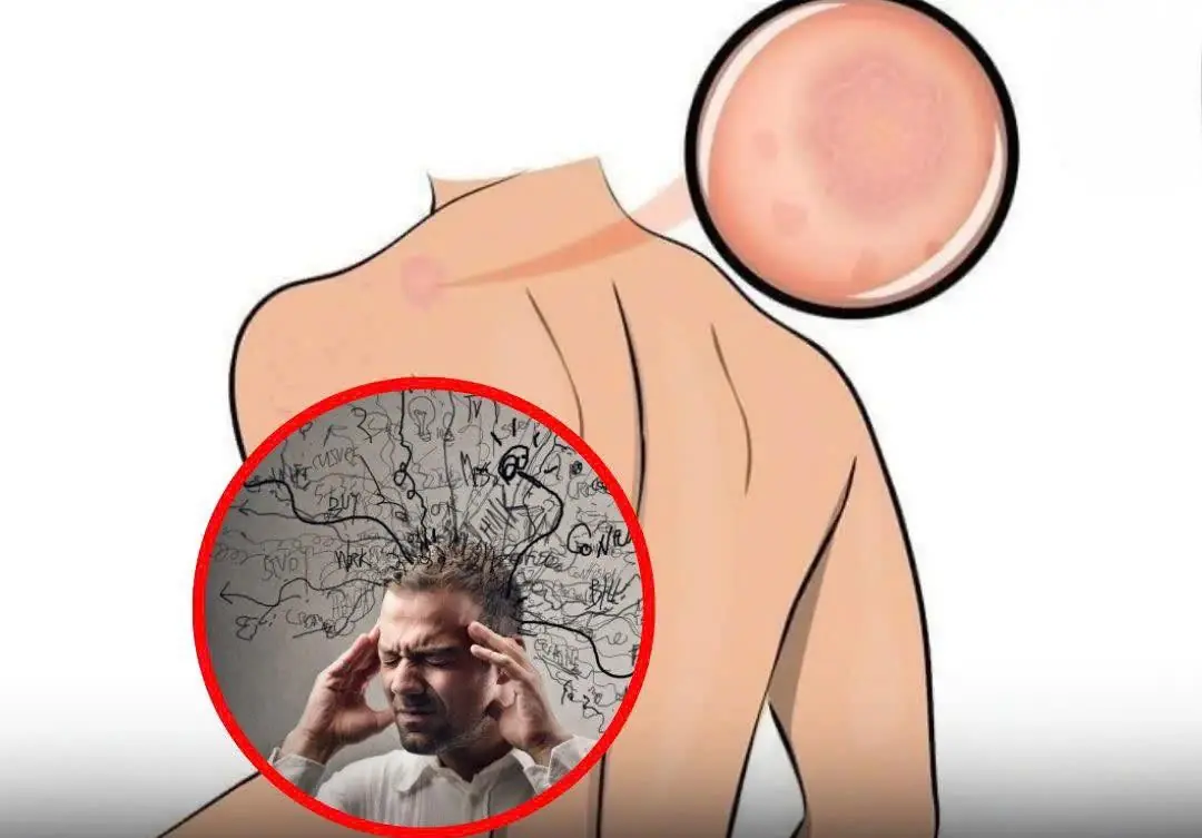 7 Warning Signals Your Body Sends When Stress Is Taking Over