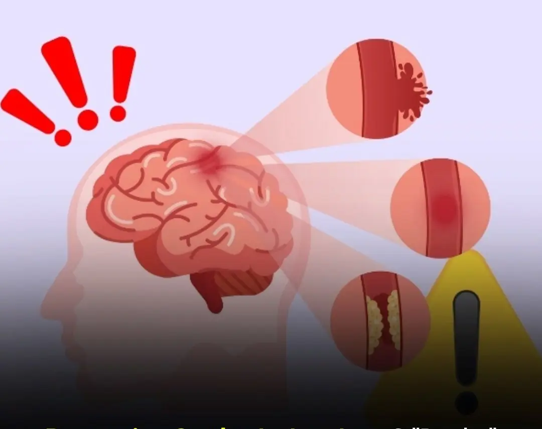 Doctors Warn: 3 Things You Should Never Do After Meals and 4 Before Bed to Prevent Stroke