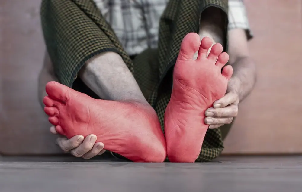 Your Feet Could Reveal Diabetes Early — 7 Warning Signs You Should Not Ignore