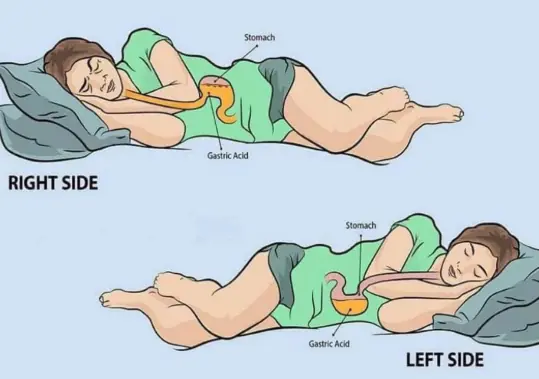 What sleeping on the left side