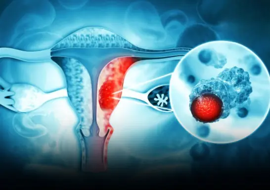 3 intimate habits of husbands that may increase wives' ri.sk of cer.vical can.cer: Stop before it's too late