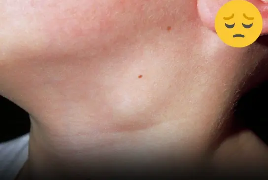 What do Neck Lumps Mean