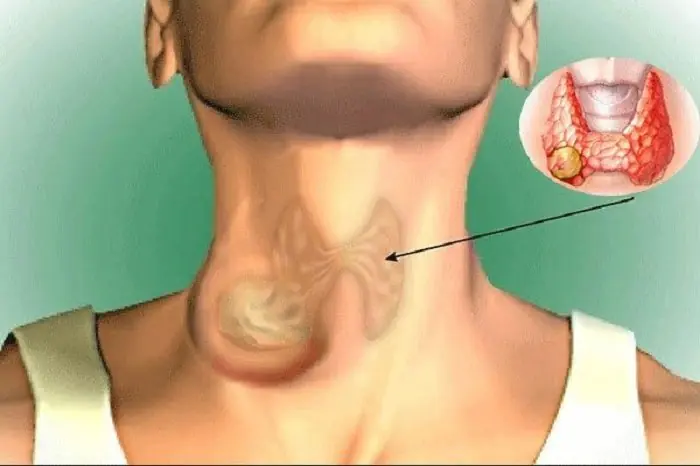 Thyroid Health Warning: Soy Myths and 2 Supplements You Should Know About