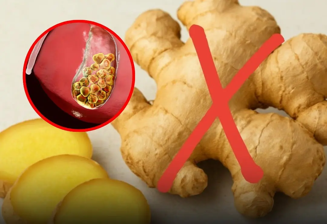 Think Ginger Is Always Safe? Avoid It If You Have These 5 Issues