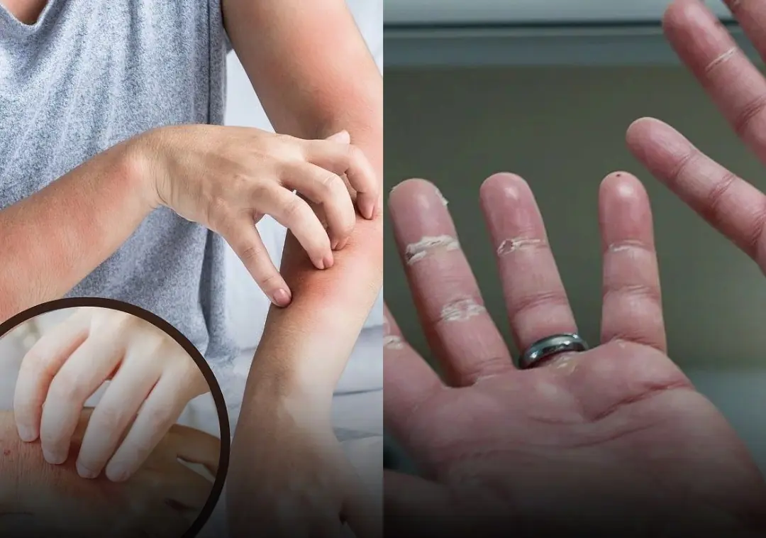 Your Hands and Feet May Show These 4 Early Signs of Ca:ncer — Don’t Ignore Them