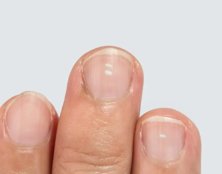 Think Those Nail Lines Are Harmless? Here’s What They Could Mean After 40