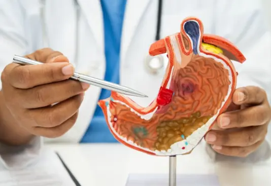 Most stomach ca.nce.rs are detected late. Doctors say there are five post-meal symptoms that may warrant early endoscopy