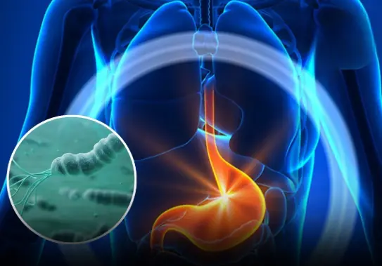 A 38-year-old female patient with gastric ul.c.er could not have imagined that just because of a familiar daily hobby