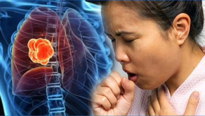Two Overlooked Cough Symptoms That May Signal Lung Can.cer, Doctors Warn