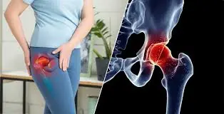 Hip Pain Isn’t Always Normal — Here’s What It Could Mean