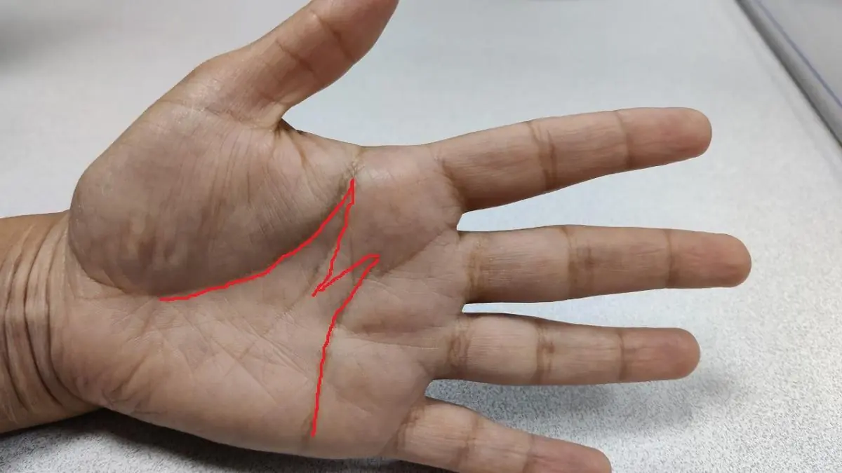 The hidden symbolism of the “M” in your palm lines